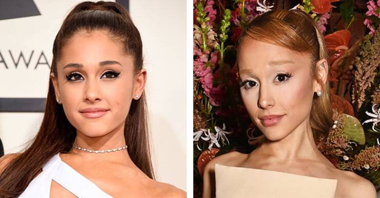 Stars Who Are Almost Unrecognizable After Plastic Surgery