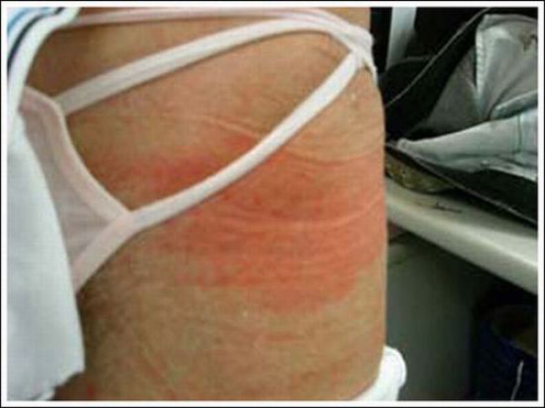 A New Guinness Record With Underpants